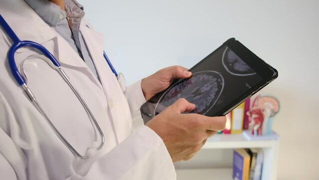Witness a hospital doctor utilizing a tablet to review a neuroimage, meticulously exploring test results. Immerse yourself in the realm of clinical medical care, neuroimaging, and the vital interplay