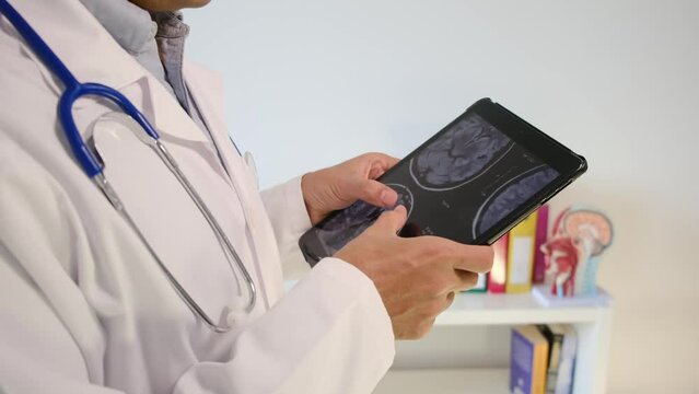  Healthcare with a hospital doctor reviewing a neuro image on a tablet, navigating through test results. Delve into the concept of clinical medical attention, neuroimaging.