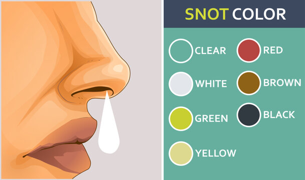 Human nose in profile. Nasal discharge. Color of nasal discharge. Healthcare illustration. Vector illustration.
