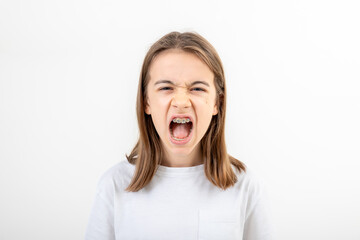 A teenage girl with braces screams with her mouth wide open.