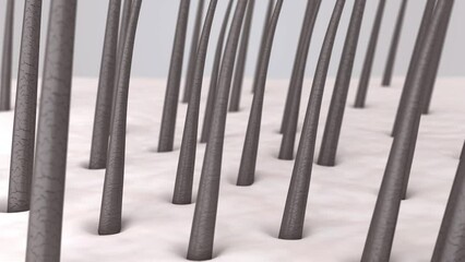 Hair loss treatment. Scalp before and after hair regrowth therapy. Intensive growth of new strong healthy hair. 3d rendered animation