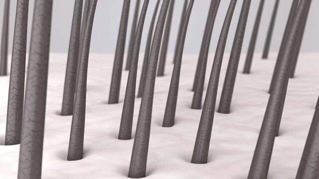 Hair loss treatment. Scalp before and after hair regrowth therapy. Intensive growth of new strong healthy hair. 3d rendered animation