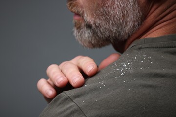 Bearded man brushing dandruff off his t-shirt on grey background, closeup. Space for text