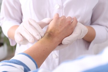 Doctor checking woman's wrist with bruise at hospital, closeup