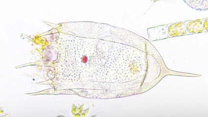 Freshwater rotifer, Keratella sp. Living sample. Stacked image