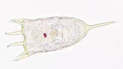 Freshwater rotifer, Keratella sp. Living sample. Stacked image