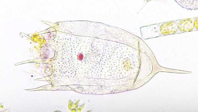Freshwater rotifer, Keratella sp. Living sample. Stacked image