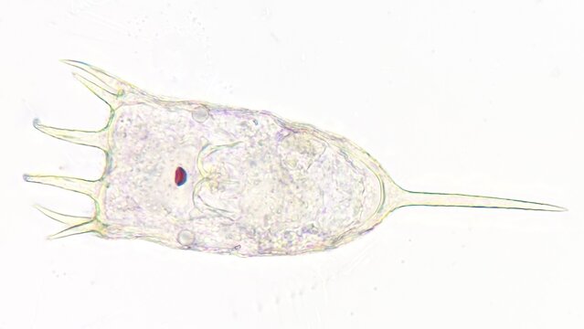 Freshwater rotifer, Keratella sp. Living sample. Stacked image