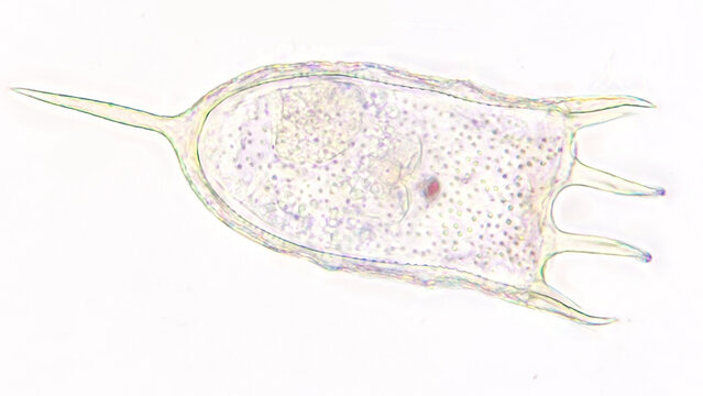 Freshwater rotifer, Keratella sp. Living sample. Stacked image