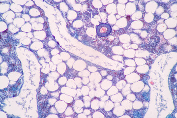 Anatomy and Histological Rea Bone marrow Human, Hyaline cartilage human and Tendon human under the microscope for education.