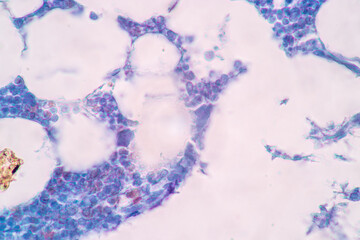 Anatomy and Histological Rea Bone marrow Human, Hyaline cartilage human and Tendon human under the microscope for education.
