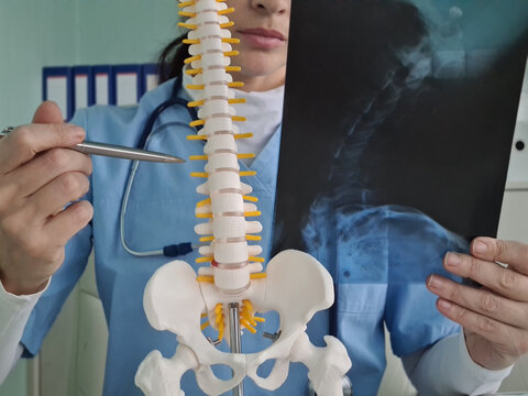 Radiologist checks x-ray image of spine and neck
