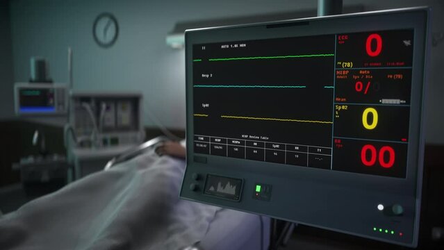 Monitoring technology examines the patients heartbeat. Heartbeat monitoring system does not detect any pulse from a patient. Monitoring system detects the slowing down of the heartbeat. Flatline.