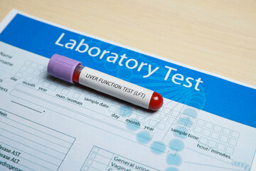 Liver Function Test. Tube with blood sample and laboratory form on wooden table