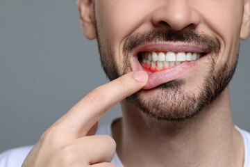 Man showing inflamed gum on grey background, closeup