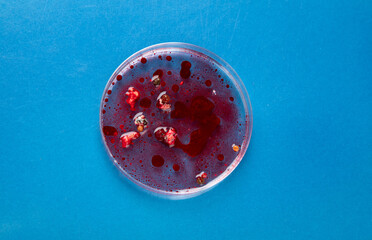 Hand in blue glove holding  petri dish with bacterium . Microbiology sience