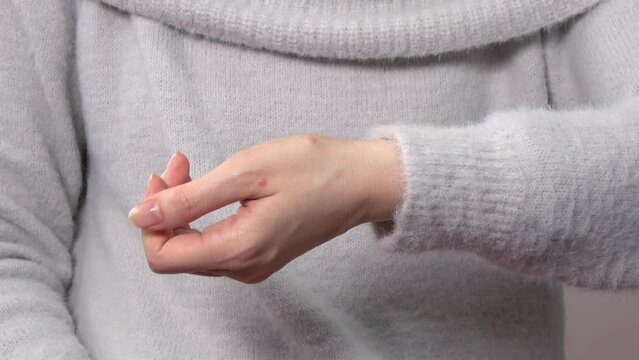 Closeup of a young woman showing multiple bug bites on her hand. 4K  Dec.11, 2023