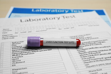 Liver Function Test. Tube with blood sample and laboratory forms on table
