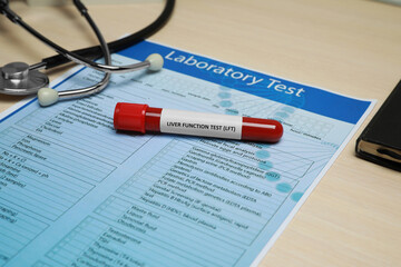Liver Function Test. Tube with blood sample, stethoscope and laboratory form on wooden table