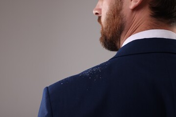 Man with dandruff on his suit against grey background, closeup. Space for text - obrazy, fototapety, plakaty