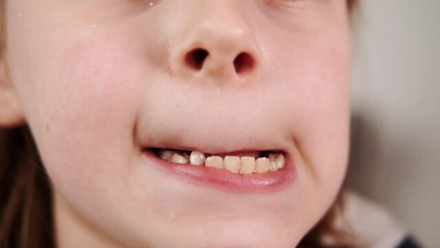 Macro view of a young boy's mouth with a wobbly tooth, promoting dental care practices