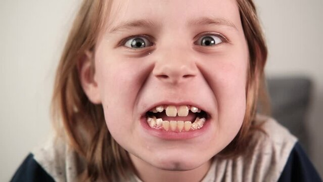 A young boy with long hair making funny faces to display his crooked teeth, emphasizing dental care