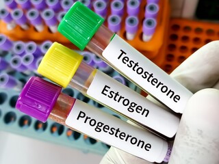 Female hormone (Estrogen, Testosterone, Progesterone) test.