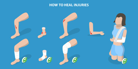 3D Isometric Flat Vector Illustration of How To Heal Injuries, Methods of Bandaging