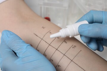 Doctor doing skin allergy test at light table, closeup