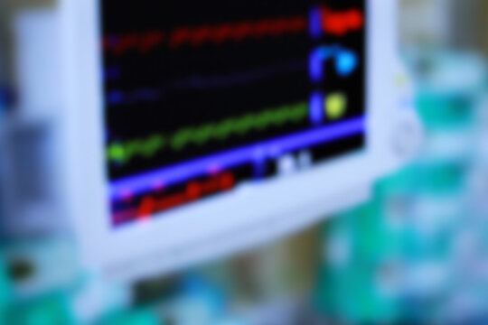 Modern vital sign and heart rate monitor in the hospital focus blur.