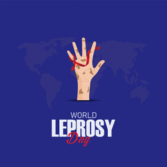 World Leprosy Day, observed on the last Sunday of January, is a global initiative to raise awareness about leprosy.