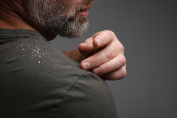 Bearded man brushing dandruff off his t-shirt on grey background, closeup. Space for text - obrazy, fototapety, plakaty