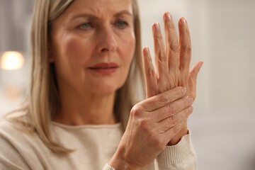 Obraz na płótnie Canvas Mature woman suffering from pain in hand on blurred background, selective focus. Rheumatism symptom