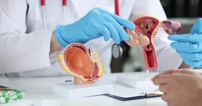 The doctor shows the anatomical model of the uterus, close-up. Obstetrician consultation, ectopic pregnancy
