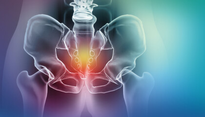 Painful Hip skeleton, x-ray view, Medical concept. 3d illustration - obrazy, fototapety, plakaty