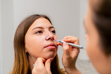 close-up plastic surgeon makes marks on a patient's face during a consultation before a nose operation