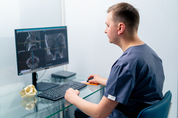 a radiologist doctor looks at a screen showing a 3D image of a nose scan to determine the results...