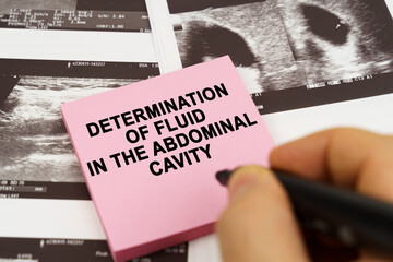 On the ultrasound pictures there are stickers that say - determination of fluid in the abdominal...