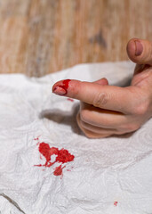 A woman's hand with a cut finger, bleeding heavily.