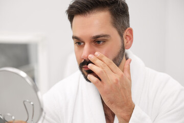 Man with skin problem looking at mirror indoors