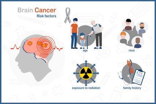 Brain cancer. Medical vector illustration in flat style.risk factors of brain cancer.age,race or ethnicity,exposure to radiation,family history.isolate on white background.