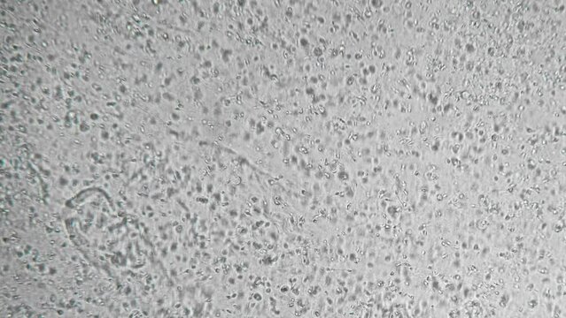 Genetic sample. Reproductive function of man. Slow motion filming of the movement of active spermatozoa under a microscope. Sperm bank. The survival of all mankind. Macro