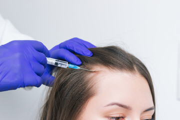 Fototapeta premium A young woman suffering for hair loss receiving injections into the scalp for hair growth. PRP therapy for hair Loss. Mesotherapy for hair growth.