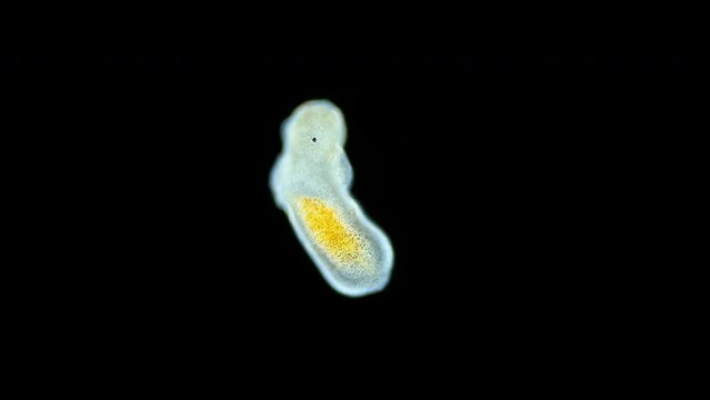 Larva under a microscope, possibly a Platyhelminthes worm. Species not defined. Specimen found in White Sea