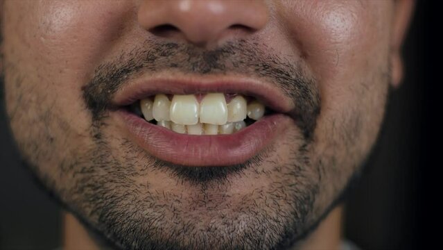 Close-up of a man smiling: yellow teeth  tooth problem  unhealthy tooth  bearded man  teeth whitening problem. Well-groomed young man close-up portrait - perfect teeth after dental clinic procedure