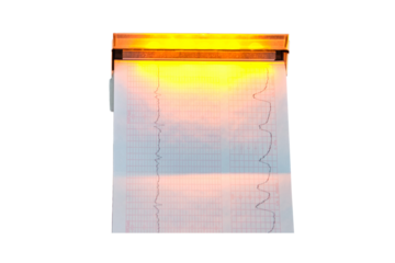 CTG device with monitoring of the state of health of the mother and child during childbirth in the hospital. Cardiotocograph device for measuring the baby pulse, isolated on a white background