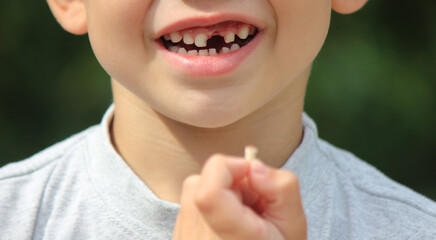 The child lost a tooth. Selective focus.Concept baby tooth