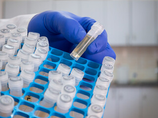 Close-up, dangerous substances in a test tube, a set of test tubes in a box, a scientist shows the...