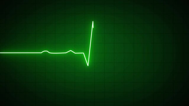 Glowing green neon heartbeat pulse rate line. Health and Medical concept. EKG Pulse Wave, cardiogram and rhythm