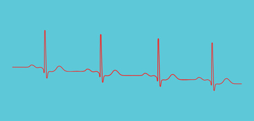 Ventricular repolarization, Cardiac cycle, ECG of heart in normal sinus rhythm, QT interval of ECG.